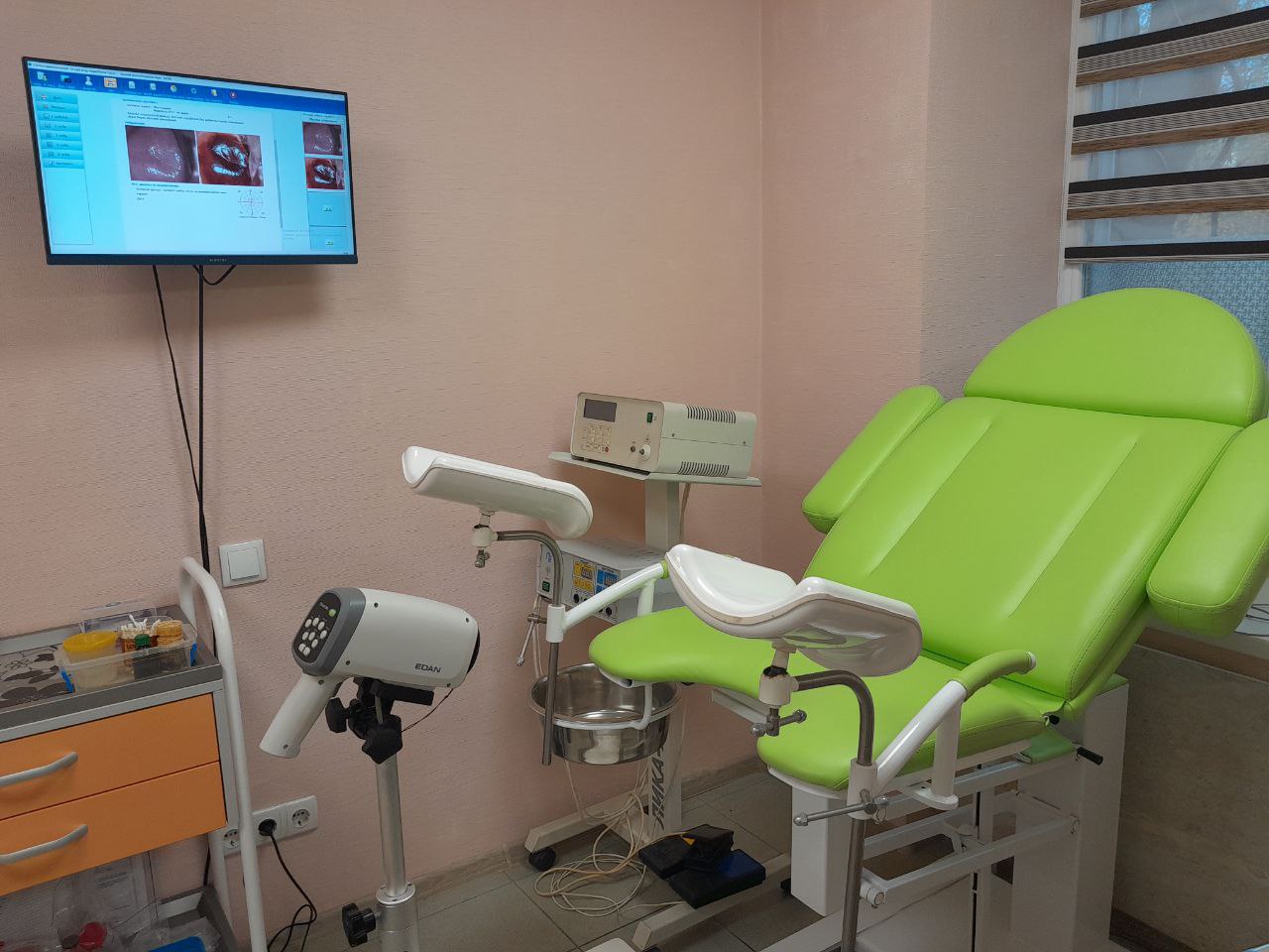 Кольпоскопія. Лікування патології шийки матки